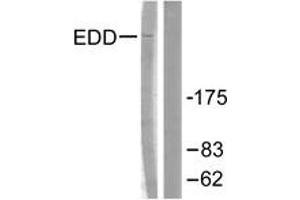 Image no. 1 for anti-Ubiquitin Protein Ligase E3 Component N-Recognin 5 (UBR5) (AA 1-50) antibody (ABIN1533426)
