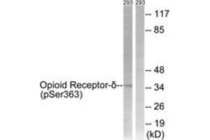 Western blot analysis of extracts from 293 cells treated with TSA 400nM 24h, using Opioid Receptor-delta (Phospho-Ser363) Antibody.