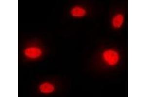 Image no. 1 for anti-Heterogeneous Nuclear Ribonucleoprotein M (HNRNPM) (N-Term) antibody (ABIN2957623)