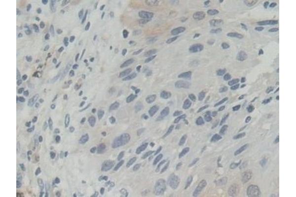 BLVRB antibody  (AA 2-206)