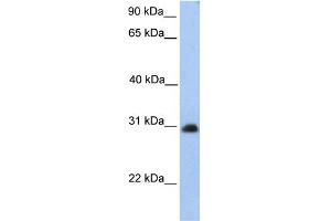 CHST14 antibody  (Middle Region)