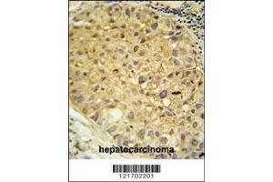 Immunohistochemistry (IHC) image for anti-Dopa Decarboxylase (Aromatic L-Amino Acid Decarboxylase) (DDC) antibody (ABIN2160522)