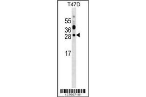 Image no. 1 for anti-phosphoribosyl Transferase Domain Containing 1 (PRTFDC1) (AA 165-192), (C-Term) antibody (ABIN1536768)