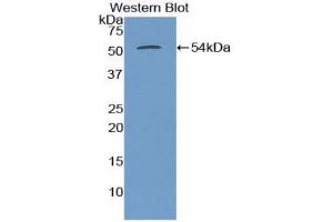 Detection of Recombinant TUBb3, Human using Polyclonal Antibody to Tubulin Beta 3 (TUBb3)