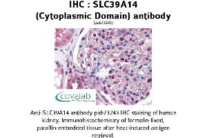 anti-Solute Carrier Family 39 (Zinc Transporter), Member 14 (SLC39A14) (Cytoplasmic Domain) antibody