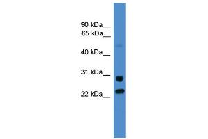 Image no. 2 for anti-Malectin (MLEC) (C-Term) antibody (ABIN2782536)