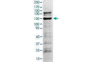 Image no. 1 for anti-Janus Kinase 2 (JAK2) (pTyr1007), (pTyr1008) antibody (ABIN541065)