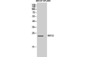 Image no. 1 for anti-RAS-Like, Family 10, Member A (RASL10A) (Internal Region) antibody (ABIN3186841)