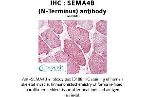 Image no. 2 for anti-Sema Domain, Immunoglobulin Domain (Ig), Transmembrane Domain (TM) and Short Cytoplasmic Domain, (Semaphorin) 4B (SEMA4B) (N-Term) antibody (ABIN1739129)