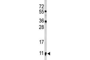 Image no. 5 for anti-S100 Calcium Binding Protein A10 (S100A10) (AA 12-40) antibody (ABIN3032510)