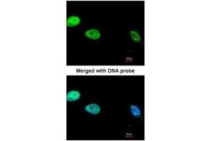 Image no. 3 for anti-Polymerase (DNA Directed), delta 1, Catalytic Subunit 125kDa (POLD1) (Center) antibody (ABIN2855506)