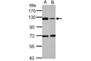 Image no. 4 for anti-Poly (ADP-Ribose) Polymerase 1 (PARP1) (Center) antibody (ABIN2854798)