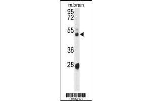 Image no. 1 for anti-Cytochrome P450, Family 3, Subfamily A, Polypeptide 4 (CYP3A4) (AA 242-270) antibody (ABIN652422)