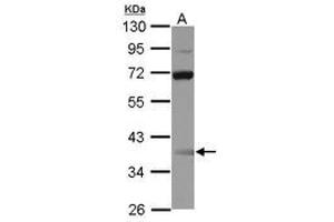 Image no. 1 for anti-Single Stranded DNA Binding Protein 3 (SSBP3) (AA 1-175) antibody (ABIN1501148)
