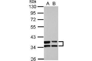 WB Image Sample (30 ug of whole cell lysate) A: A549 B: HCT116 10% SDS PAGE antibody diluted at 1:10000