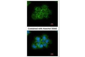 ICC/IF Image Immunofluorescence analysis of methanol-fixed A431, using CRK, antibody at 1:200 dilution.