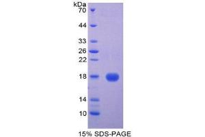 Image no. 1 for Cystatin D (CST5) (AA 21-142) protein (His tag,T7 tag) (ABIN1878626)