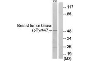 Western blot analysis of extracts from 293 cells treated with EGF 200ng/ml 30', using Breast Tumor Kinase (Phospho-Tyr447) Antibody.