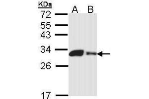 Image no. 2 for anti-Carbonic Anhydrase II (CA2) (Center) antibody (ABIN2856125)