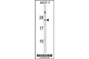 Western Blotting (WB) image for anti-Cytochrome B5 Domain Containing 1 (CYB5D1) (Center) antibody (ABIN2160446)