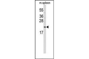 Image no. 3 for anti-Interleukin 31 (IL31) (AA 19-49), (N-Term) antibody (ABIN952927)
