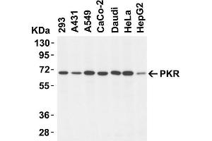 Image no. 3 for anti-Eukaryotic Translation Initiation Factor 2-alpha Kinase 2 (EIF2AK2) (N-Term) antibody (ABIN6657000)