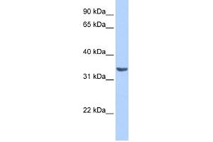 Image no. 1 for anti-RAB40A, Member RAS Oncogene Family (RAB40A) (Middle Region) antibody (ABIN2784971)