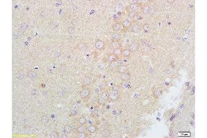 Formalin-fixed and paraffin embedded rat brain tissue labeled with Anti-GABRA1 Polyclonal Antibody, Unconjugated at 1:200 followed by conjugation to the secondary antibody and DAB staining