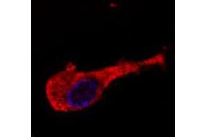 Image no. 1 for anti-Neurofilament Triplet M Protein (NEFM) antibody (ABIN535485)
