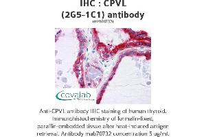 Image no. 2 for anti-Carboxypeptidase, Vitellogenic-Like (CPVL) (AA 1-477), (full length) antibody (ABIN1723589)