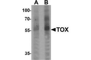 Image no. 1 for anti-Thymus High Mobility Group Box Protein (TOX) (N-Term) antibody (ABIN1449998)