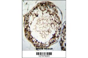 Image no. 1 for anti-Testis Specific Serine Kinase 4 (TSSK4) (AA 226-254), (C-Term) antibody (ABIN655194)