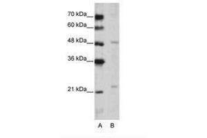 Image no. 1 for anti-WD Repeat Domain 12 (WDR12) (C-Term) antibody (ABIN202489)
