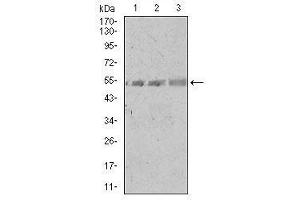 Image no. 5 for anti-Spi-B Transcription Factor (Spi-1/PU.1 Related) (SPIB) antibody (ABIN1491174)