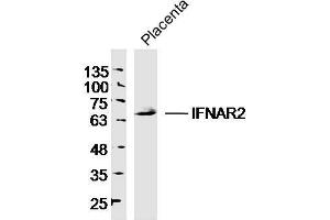 Image no. 5 for anti-Interferon alpha/beta Receptor 2 (IFNAR2) (AA 165-260) antibody (ABIN721825)