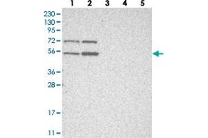 Image no. 2 for anti-ZFP69 Zinc Finger Protein (ZFP69) antibody (ABIN5591414)