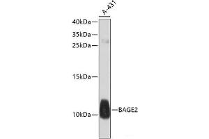 Western blot analysis of extracts of A-431 cells using BAGE2 Polyclonal Antibody at dilution of 1:1000.