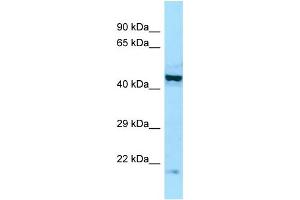 Image no. 2 for anti-Eukaryotic Translation Initiation Factor 2B, Subunit 2 Beta, 39kDa (EIF2B2) (Middle Region) antibody (ABIN2790211)