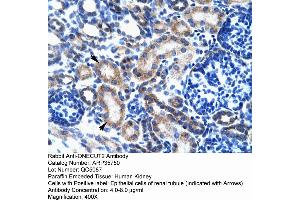 Image no. 2 for anti-One Cut Homeobox 2 (ONECUT2) (Middle Region) antibody (ABIN2776431)