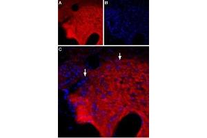 Expression of of GABA(A) θ receptor in rat hypothalamus - Immunohistochemical staining of rat hypothalamus using Anti-GABA(A) θ Receptor (GABRQ) (extracellular) Antibody (ABIN7043197, ABIN7044315 and ABIN7044316).