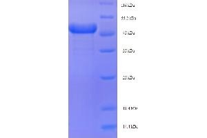Image no. 1 for Arginase, Type II (ARG2) (AA 23-354) protein (His-SUMO Tag) (ABIN5709077)