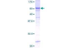 Image no. 2 for Receptor-Interacting serine-threonine Kinase 3 (RIPK3) (AA 1-518) protein (GST tag) (ABIN1318116)