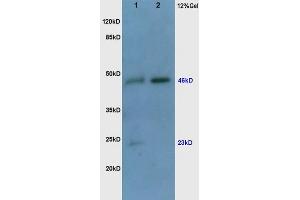 Image no. 6 for anti-Vascular Endothelial Growth Factor (VEGF) (AA 27-120) antibody (ABIN727205)
