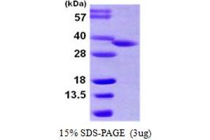Image no. 1 for Hydroxysteroid (17-Beta) Dehydrogenase 8 (HSD17B8) (AA 1-261) protein (His tag) (ABIN667899)