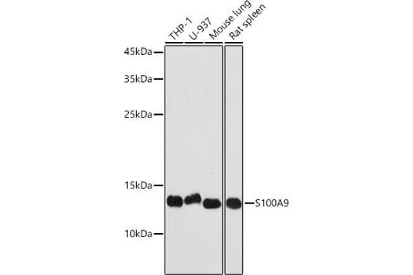 S100A9 Antikörper  (AA 1-114)
