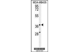 Image no. 2 for anti-phosphoribosyl Pyrophosphate Synthetase-Associated Protein 1 (PRPSAP1) (AA 30-59), (N-Term) antibody (ABIN654357)