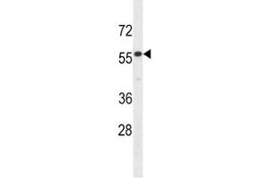 Image no. 2 for anti-Interleukin 17 Receptor E (IL17RE) (AA 87-116) antibody (ABIN3028756)