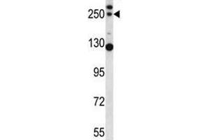 Image no. 1 for anti-Complement Component C4b (C4b) (AA 655-684) antibody (ABIN3030240)