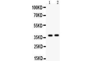 Image no. 1 for anti-Calbindin 2 (CALB2) (AA 234-262), (C-Term) antibody (ABIN3043772)
