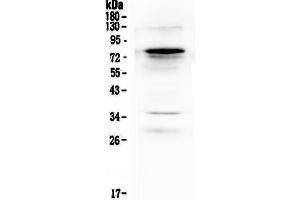 Image no. 1 for anti-Complement Component C9 (C9) (AA 289-515) antibody (ABIN5692808)